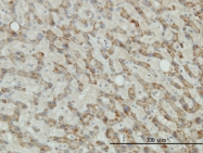 H00007299-M01 - Tyrosinase (TYR)