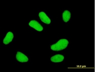 H00007325-M01 - UBE2E2