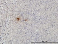 H00007356-M01 - SCGB1A1 / Uteroglobin
