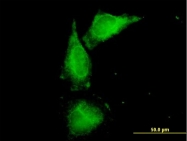 H00007369-B01P - Uromodulin (UMOD)