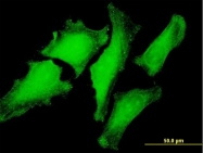 H00007411-B01 - PFDN3 / VBP1