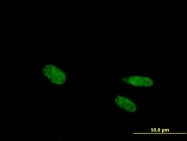 H00007421-B01P - Vitamin D3 receptor / NR1I1