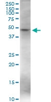 H00007421-D01 - Vitamin D3 receptor / NR1I1