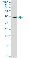 H00007433-D01 - PACAP type II Receptor / VIP Receptor