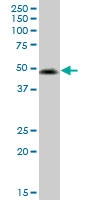 H00007434-M01 - PACAP type III receptor / VIP Receptor 2