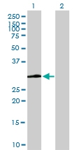 H00007450-B02P - von Willebrand factor (VWF)