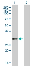 H00007450-D01P - von Willebrand factor (VWF)