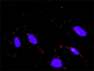 H00007465-D01P - WEE1 / Wee1-like protein kinase