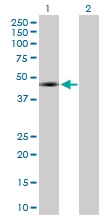 H00007490-D01P - WT1 / Wilms tumor protein