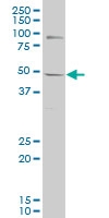 H00007490-M01 - WT1 / Wilms tumor protein