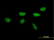 H00007507-B01P - XPA / XPAC