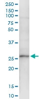 H00007517-D01 - XRCC3