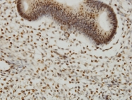 H00007528-M03 - YY1