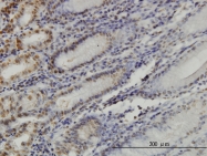 H00007528-M04 - YY1