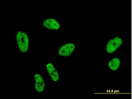 H00007536-M01 - Splicing factor 1 (SF1)