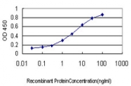 H00007536-M01 - Splicing factor 1 (SF1)