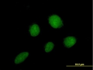 H00007549-B01 - ZNF2