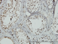 H00007639-M02 - ZNF85