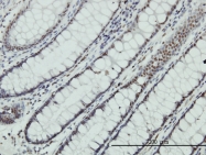H00007702-M02 - ZNF143