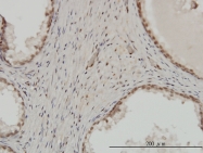 H00007753-M01 - ZNF202