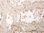 H00007760-M01 - ZNF213