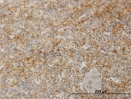 H00007791-M02 - Zyxin