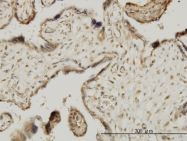 H00007867-M02 - MAPKAP Kinase-3