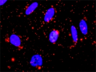 H00007867-M02 - MAPKAP Kinase-3