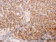 H00008031-M03 - NCoA-4