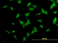 H00008031-M04 - NCoA-4