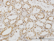 H00008031-M05 - NCoA-4