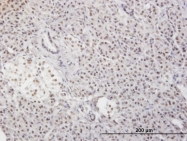 H00008079-M01 - MLF2