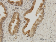 H00008086-M02 - Aladin