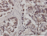 H00008087-M01 - FXR1