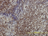 H00008125-M01 - ANP32A