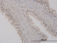 H00008128-M01 - ST8SIA2
