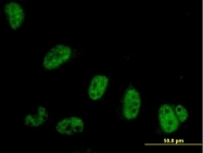 H00008189-B01 - Symplekin / SYMPK
