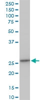 H00008209-A01 - ES1 protein homolog