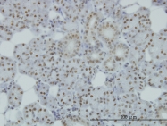 H00008243-M01 - SMC1A / SMC1
