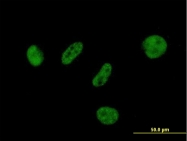 H00008314-B01 - BAP1