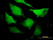 H00008318-B01 - CDC45L