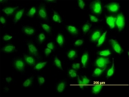 H00008351-M01 - Histone H3.1