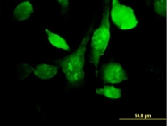 H00008372-B01P - HYAL3 / Hyaluronidase-3