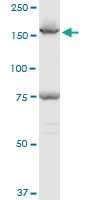 H00008411-A01 - Early endosome antigen 1