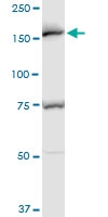 H00008411-A01 - Early endosome antigen 1
