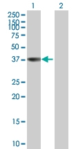 H00008416-B01P - Annexin A9 / ANXA9