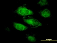 H00008416-B01P - Annexin A9 / ANXA9