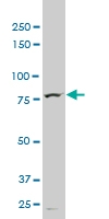 H00008458-M02 - TTF2