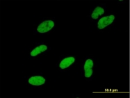 H00008467-B01 - SMARCA5