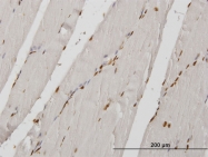 H00008479-M01 - HIRIP3